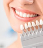 הלבנת שיניים בעזרת ציפוי - תמונת המחשה